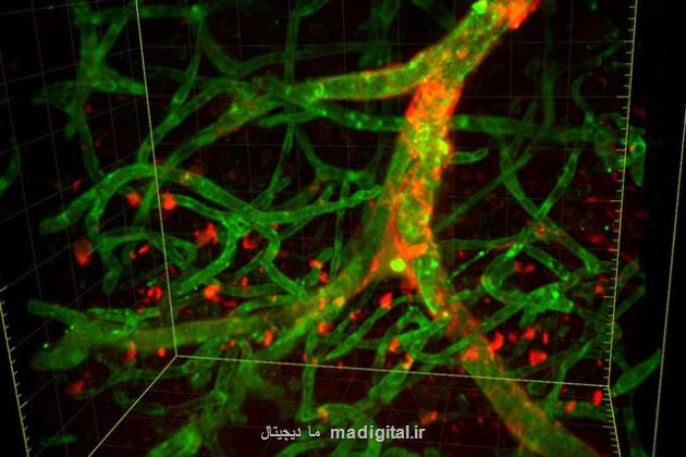 افزایش شک و تردید در مورد یک پادتن مقابله کننده با آلزایمر