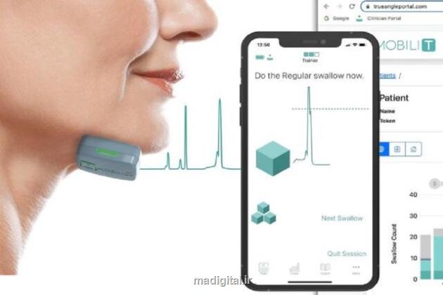 بهبود بلع در بیماران سرطانی با یک تکنولوژی جدید